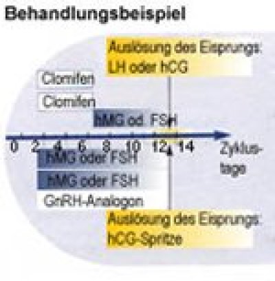 foederung der eizellreifung grafik