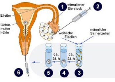 uebertragung der embryonen grafiken